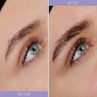 andmetics pro lifting lotions standard